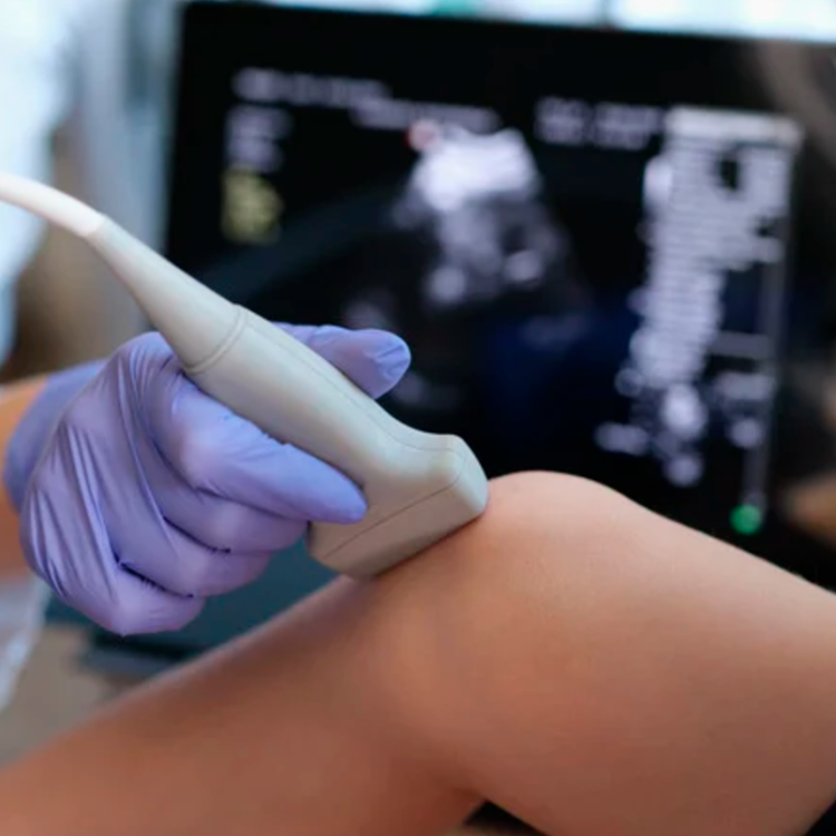 ULTRASSONOGRAFIA DIAGNÓSTICA