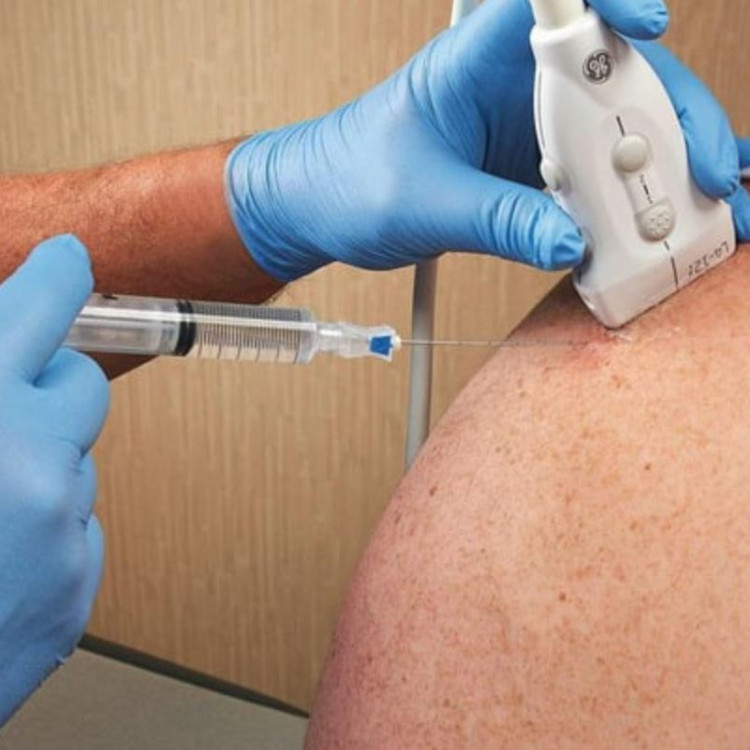 INFILTRAÇÕES GUIADAS POR ULTRASSOM